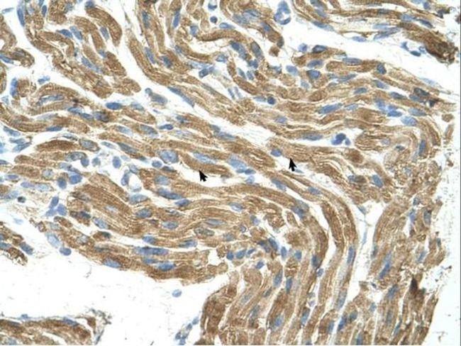 HAL Antibody in Immunohistochemistry (IHC)