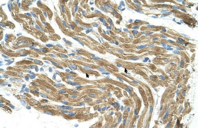 HAL Antibody in Immunohistochemistry (IHC)
