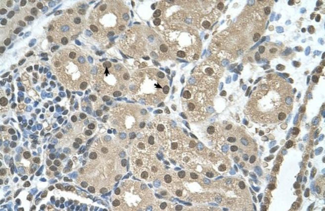 SBDS Antibody in Immunohistochemistry (IHC)