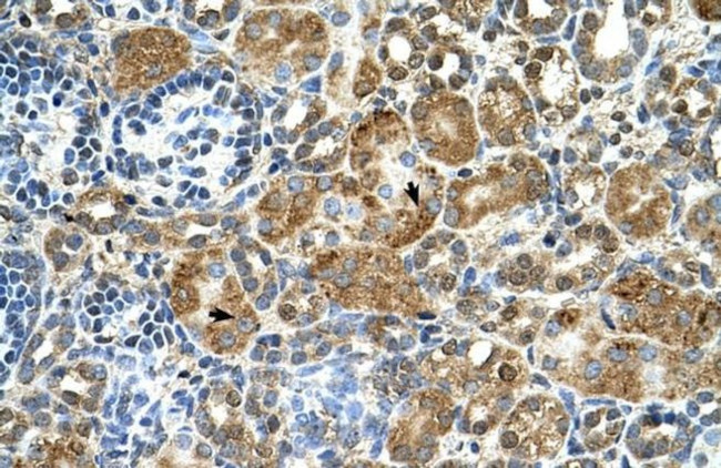 Cystatin B Antibody in Immunohistochemistry (IHC)