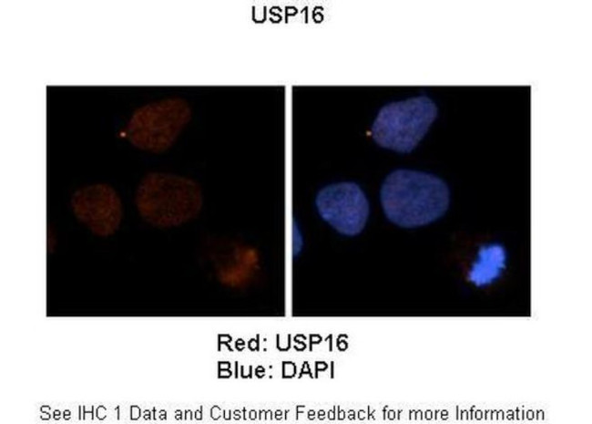 USP16 Antibody in Immunohistochemistry (IHC)