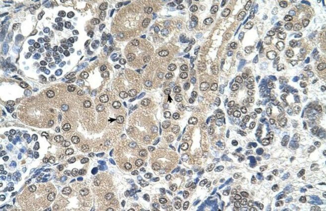 RRP1 Antibody in Immunohistochemistry (IHC)
