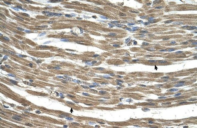 KNP-I Antibody in Immunohistochemistry (IHC)