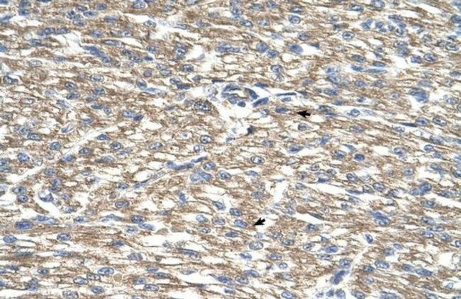 TCP10L Antibody in Immunohistochemistry (IHC)