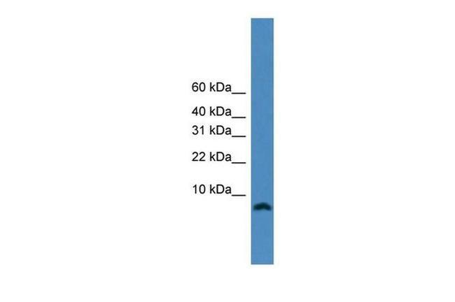 KIAA0101 Antibody in Western Blot (WB)