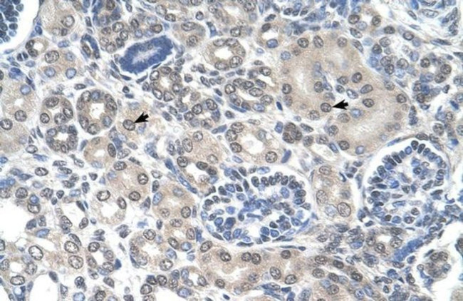 PPAT Antibody in Immunohistochemistry (IHC)