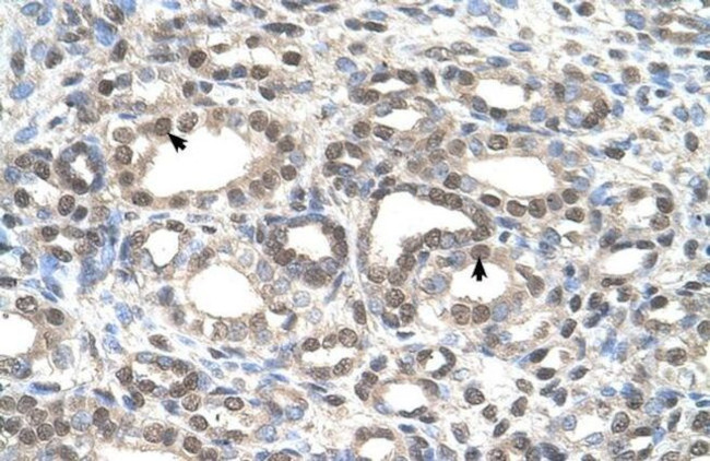 DFNA5 Antibody in Immunohistochemistry (IHC)
