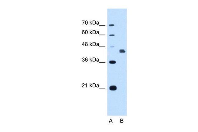 DFNA5 Antibody in Western Blot (WB)