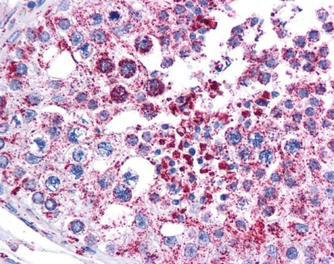 MAGEA3 Antibody in Immunohistochemistry (IHC)