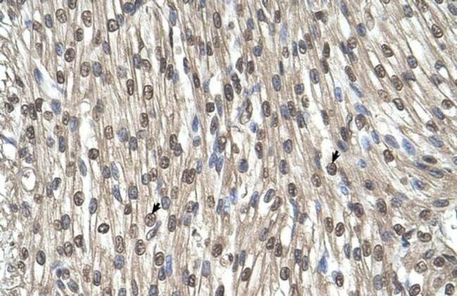 SHMT2 Antibody in Immunohistochemistry (IHC)