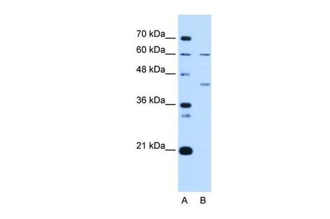 RFC5 Antibody in Western Blot (WB)