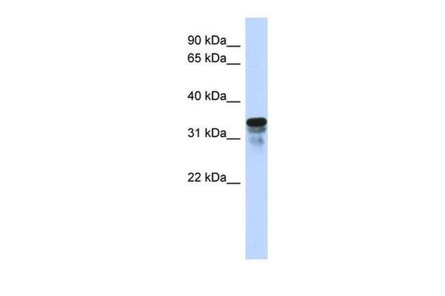 FAM82B Antibody in Western Blot (WB)