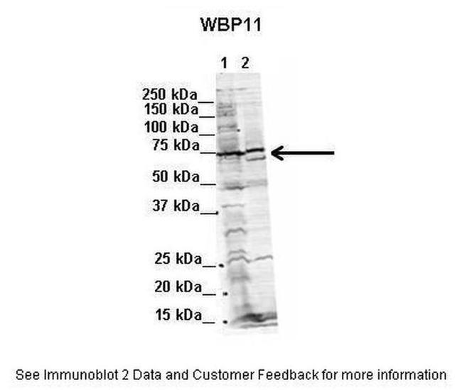 WBP11 Antibody in Western Blot (WB)