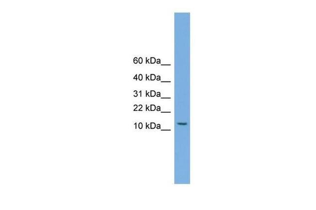 MAGEA5 Antibody in Western Blot (WB)