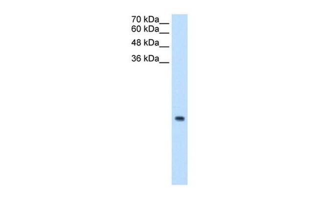 MRPS12 Antibody in Western Blot (WB)