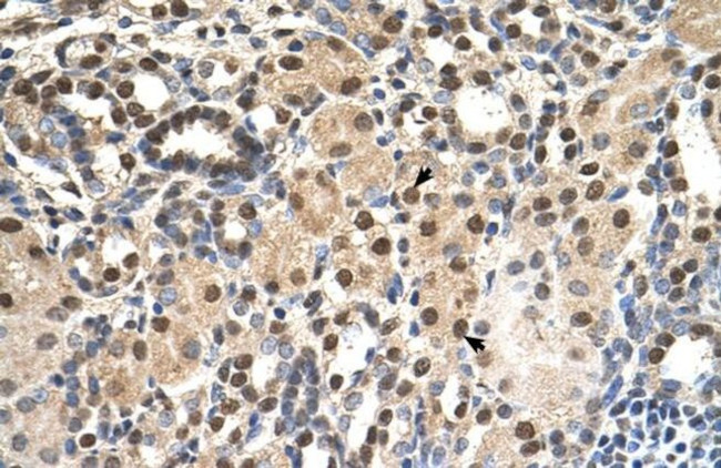 PHAP III Antibody in Immunohistochemistry (IHC)