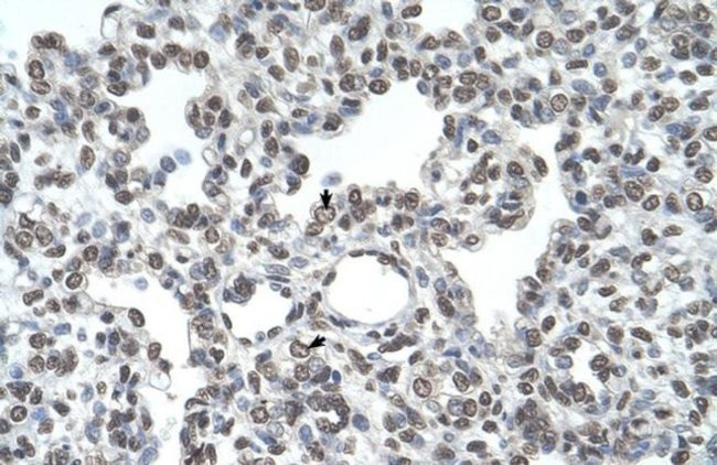 TMPRSS11D Antibody in Immunohistochemistry (IHC)