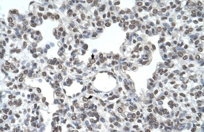 TMPRSS11D Antibody in Immunohistochemistry (IHC)