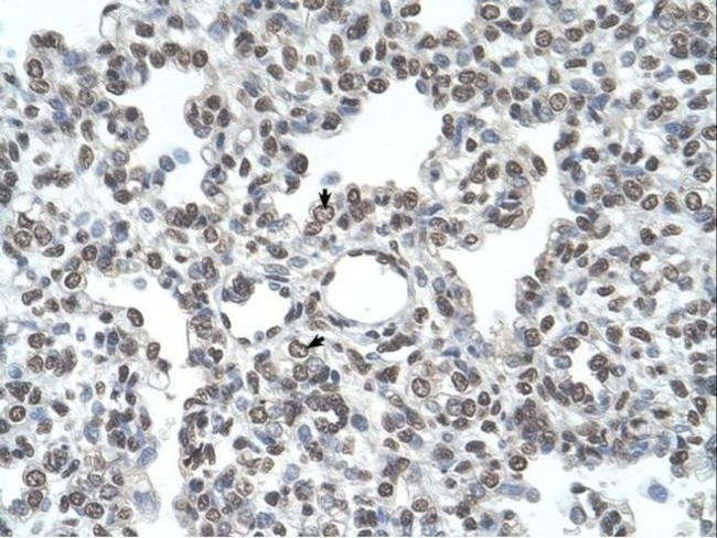 TMPRSS11D Antibody in Immunohistochemistry (IHC)