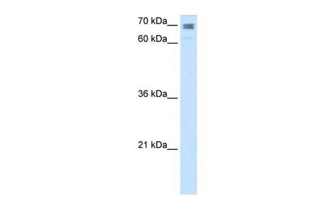 CLGN Antibody in Western Blot (WB)