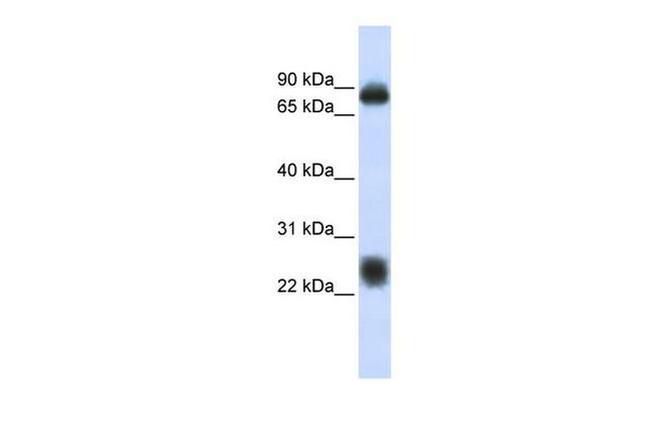 TSPAN8 Antibody in Western Blot (WB)