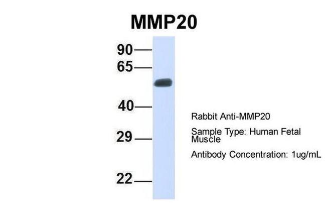 MMP20 Antibody in Western Blot (WB)