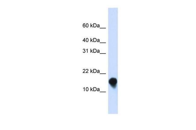 FXYD1 Antibody in Western Blot (WB)