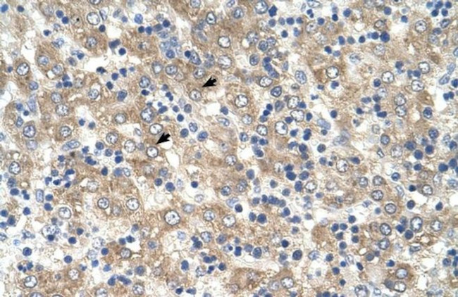 TSPAN32 Antibody in Immunohistochemistry (IHC)