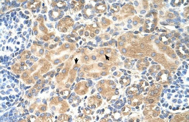 TSPAN5 Antibody in Immunohistochemistry (IHC)