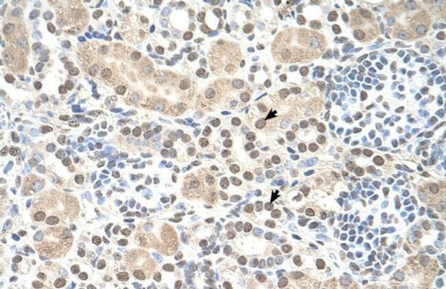 ST8SIA2 Antibody in Immunohistochemistry (IHC)