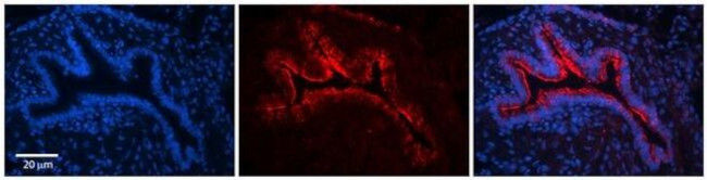 CKAP4 Antibody in Immunohistochemistry (Paraffin) (IHC (P))