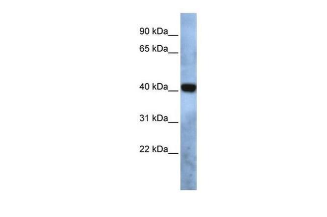 TMEM115 Antibody in Western Blot (WB)