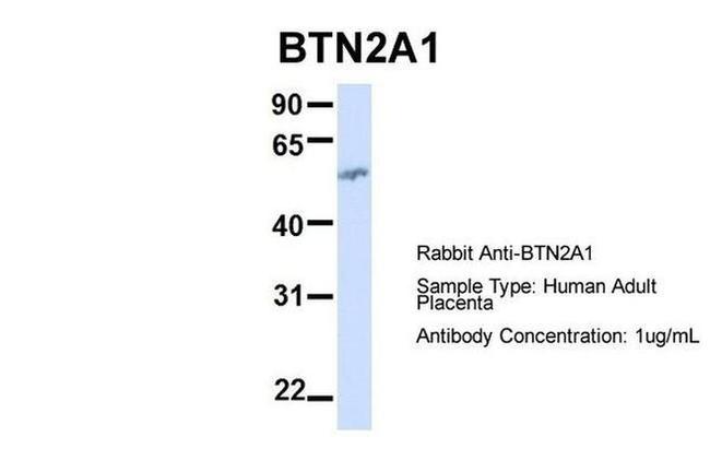 BTN2A1 Antibody in Western Blot (WB)