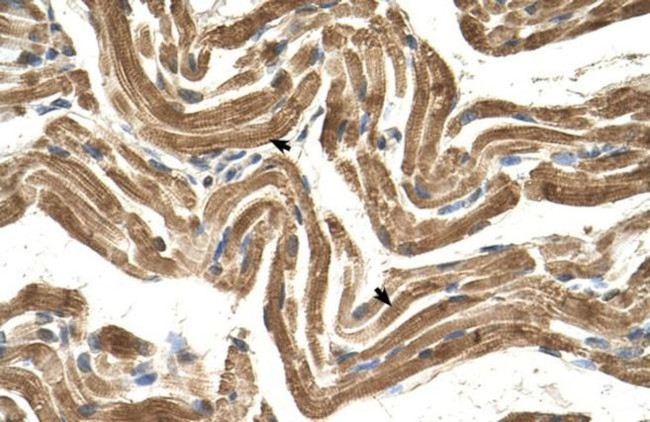 FICD Antibody in Immunohistochemistry (IHC)