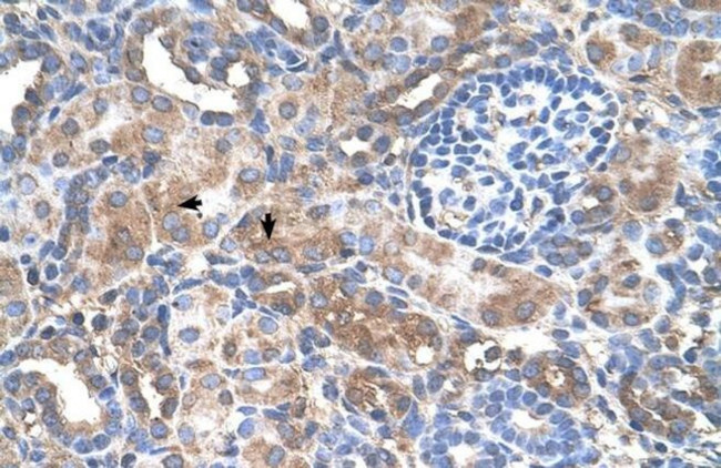 GALNT6 Antibody in Immunohistochemistry (IHC)