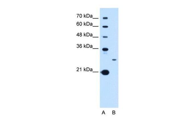 TSPAN15 Antibody in Western Blot (WB)