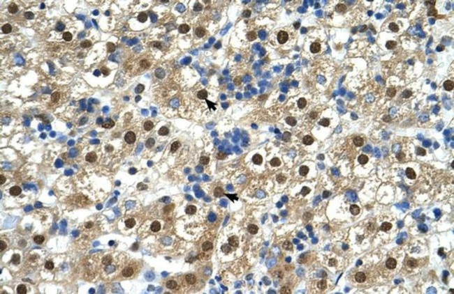 GDE1 Antibody in Immunohistochemistry (IHC)