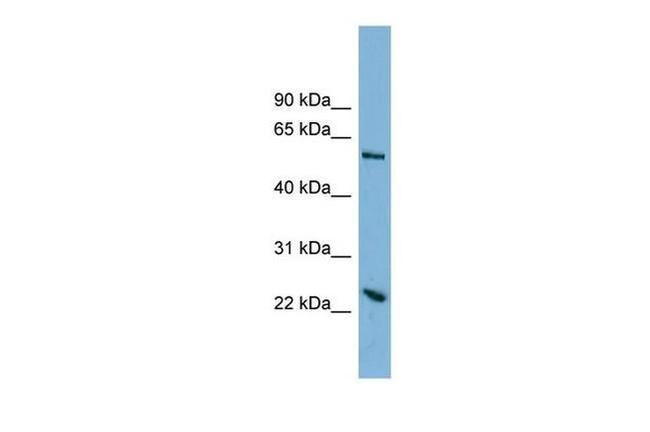 TMEM161A Antibody in Western Blot (WB)