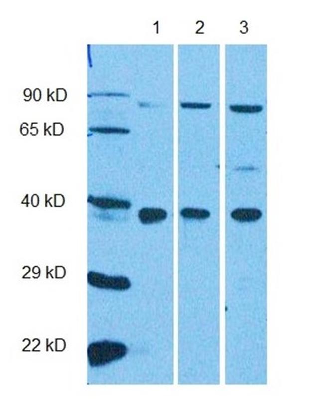 RHBDL2 Antibody in Western Blot (WB)