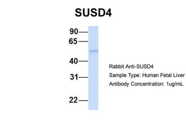 SUSD4 Antibody in Western Blot (WB)