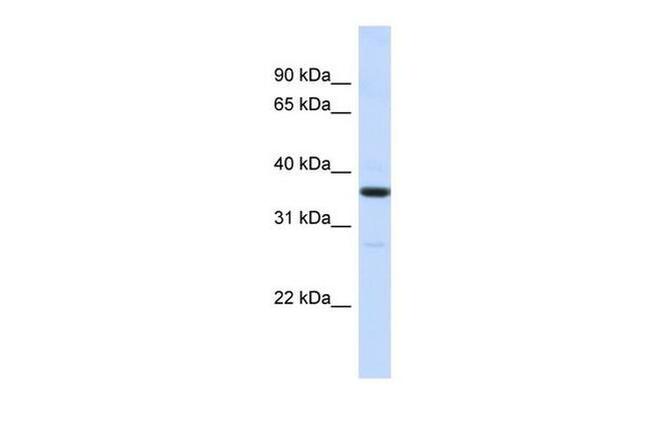 RMDN3 Antibody in Western Blot (WB)