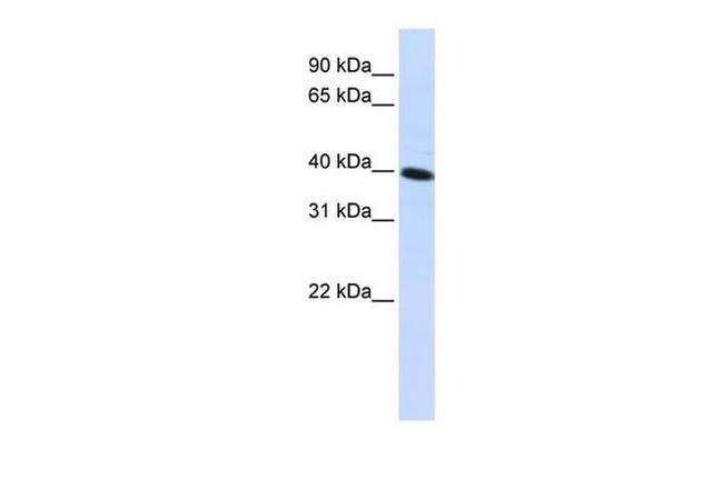 CARKD Antibody in Western Blot (WB)
