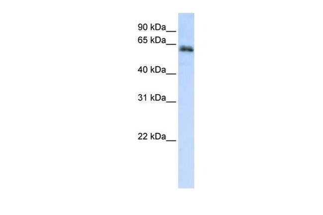 ZNF131 Antibody in Western Blot (WB)