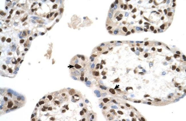 SETD2 Antibody in Immunohistochemistry (IHC)
