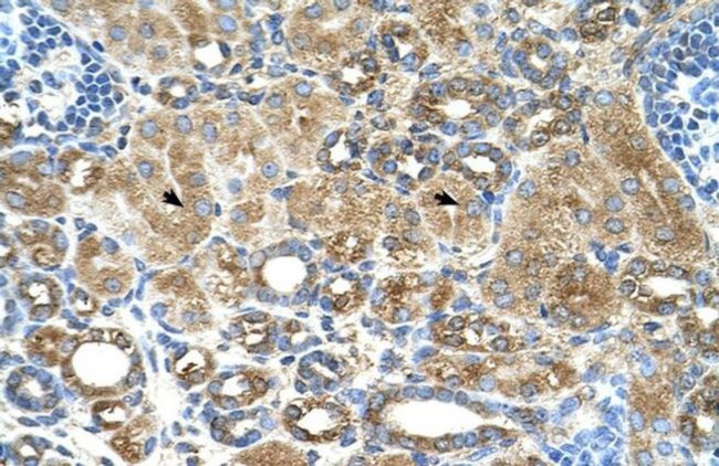 UBXD2 Antibody in Immunohistochemistry (IHC)