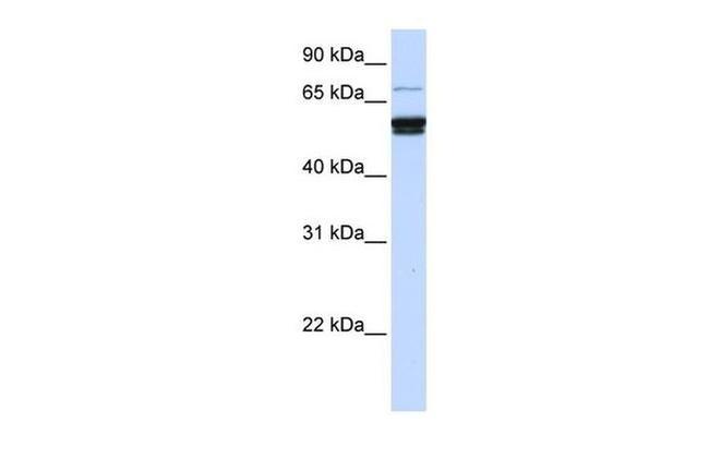 ZNF93 Antibody in Western Blot (WB)