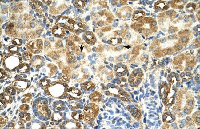 C3orf31 Antibody in Immunohistochemistry (IHC)