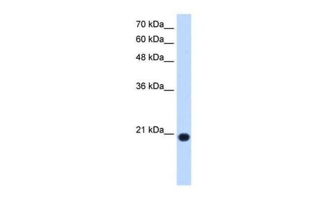 UXT Antibody in Western Blot (WB)