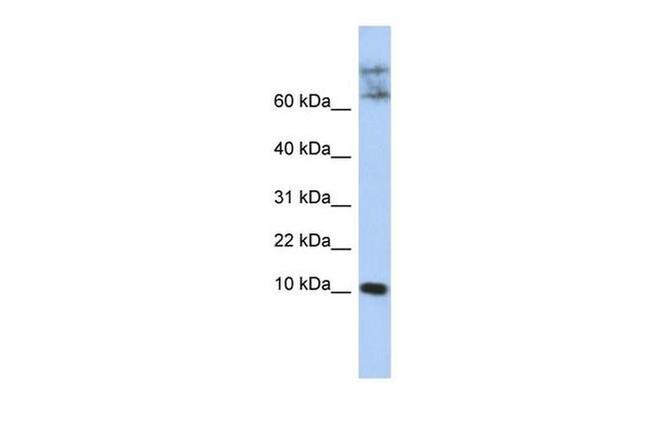 CKLF Antibody in Western Blot (WB)