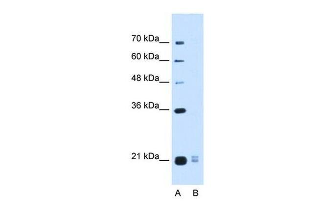 PLAC1L Antibody in Western Blot (WB)